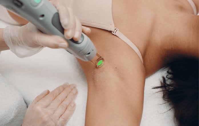Épilation laser aisselles