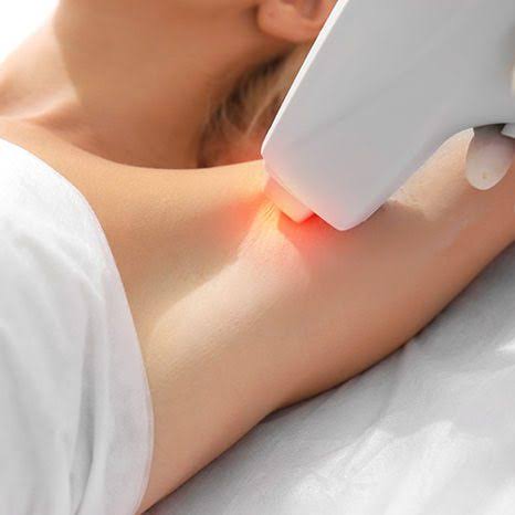 Épilation laser axillaire