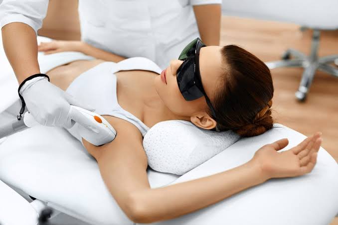 Épilation laser ventre
